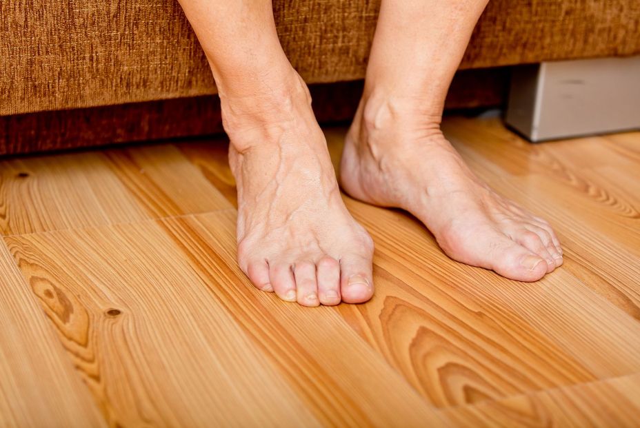 Fascitis plantar: ¿qué ejercicios puedo hacer para mejorar esta dolencia? Fascitis plantar: ¿qué ejercicios puedo hacer para mejorar esta dolencia?